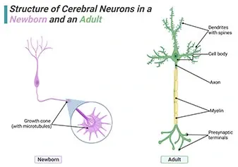 Structure of Cerebral Neurons in a Newborn and an Adult